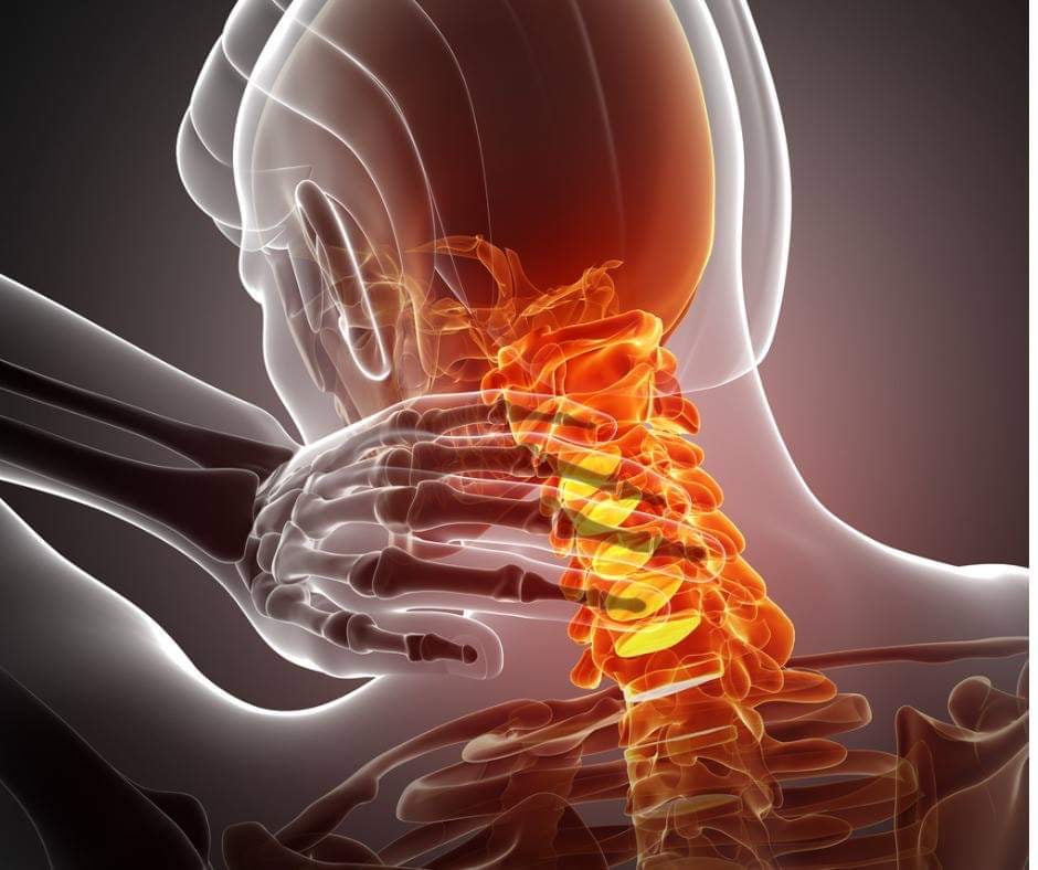Neck Pain