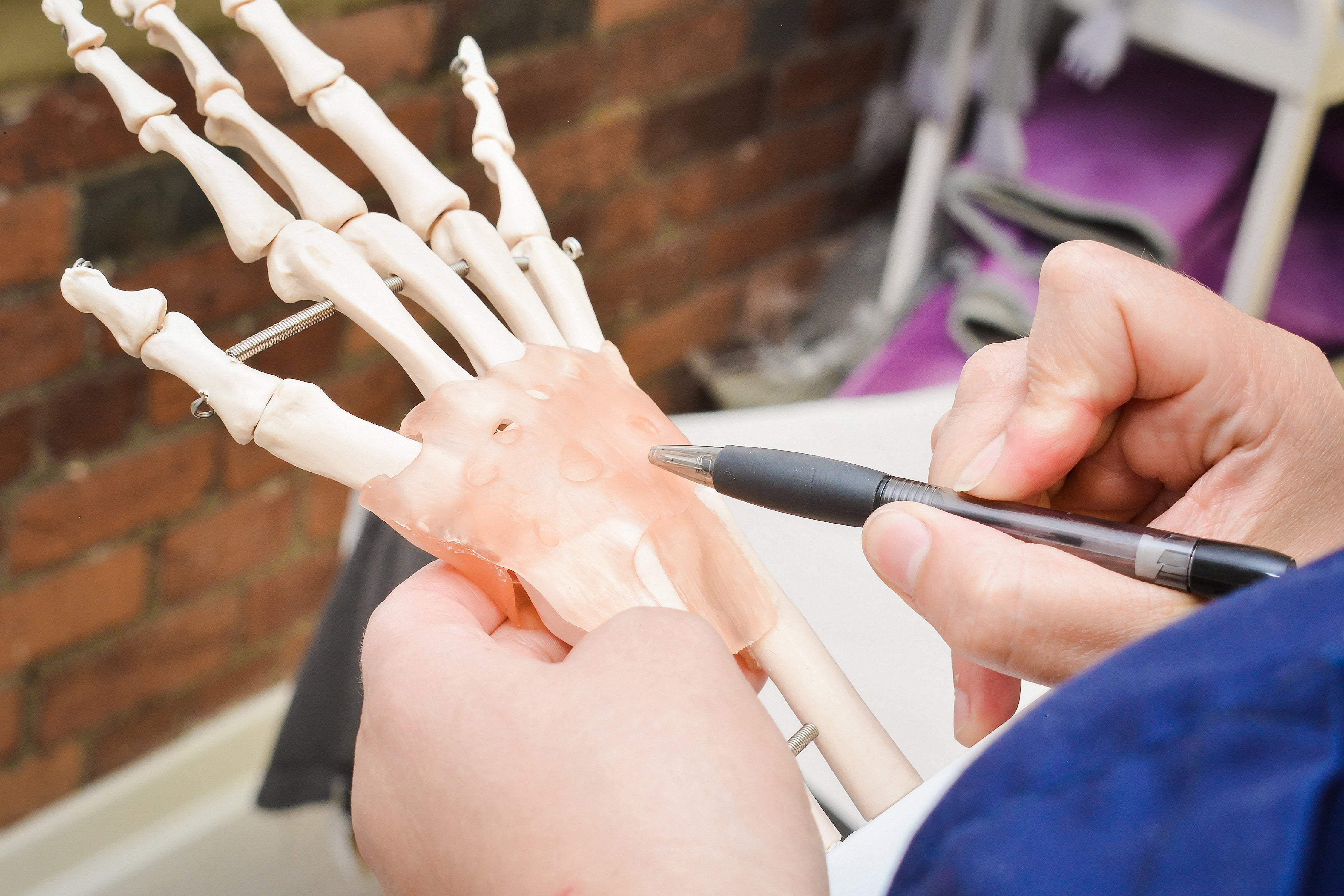 Hyaluronic Acid Joint Injections for Osteoarthritis in Synovial Joints