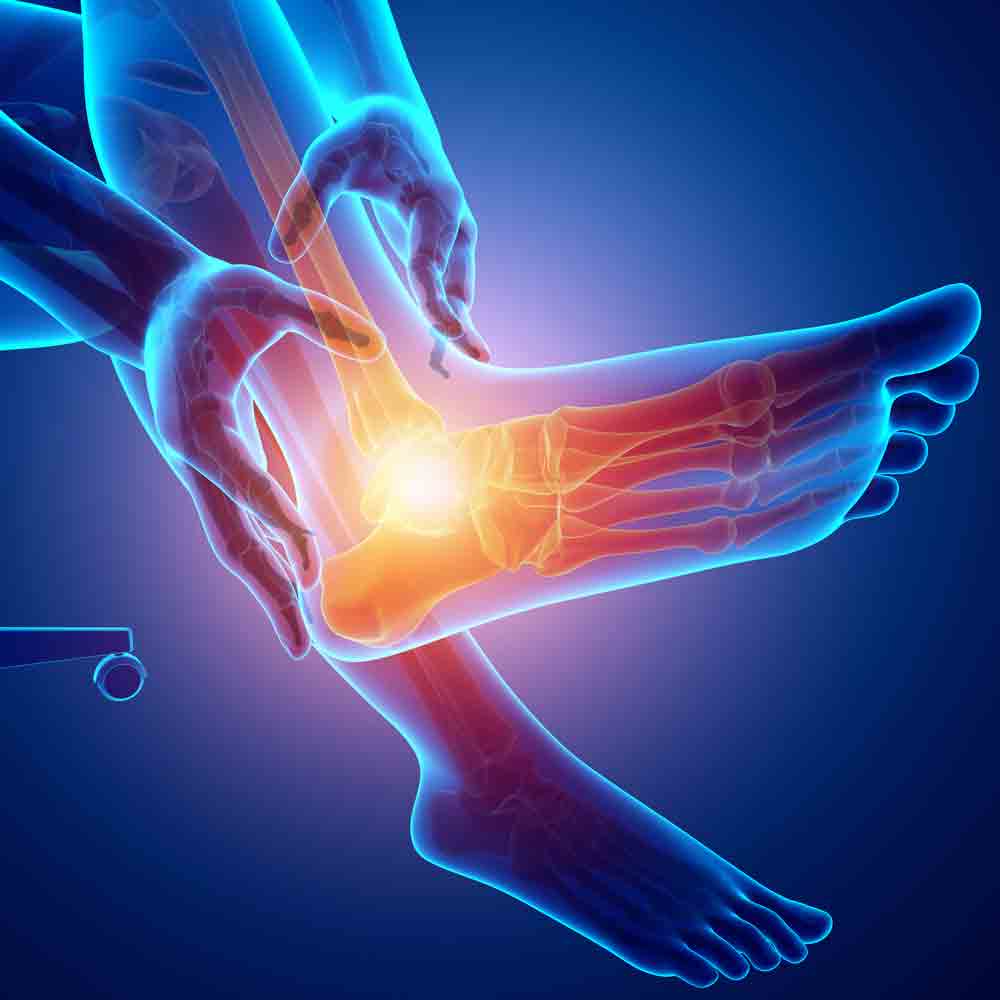 Heel Pain