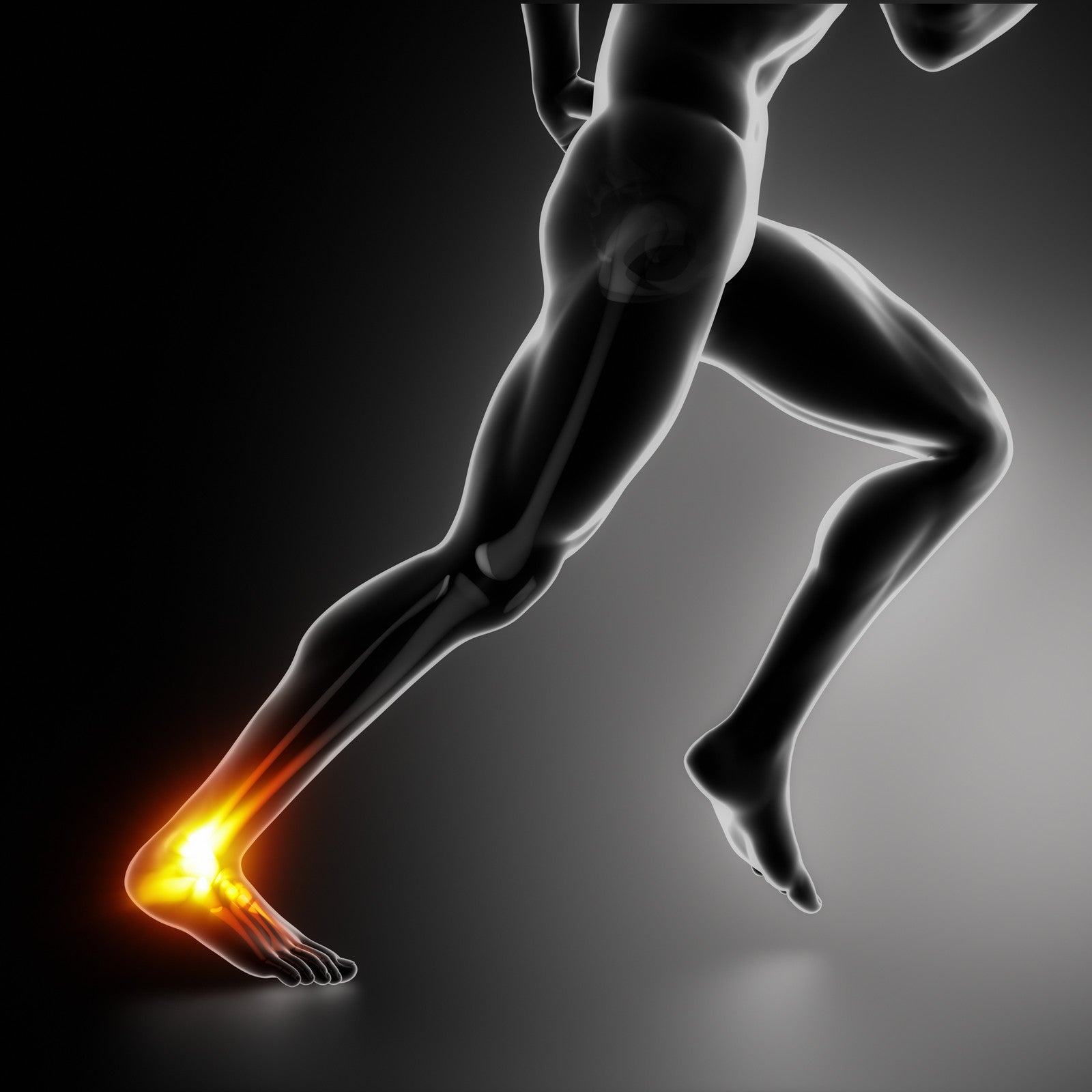 Achilles Tendon Injury