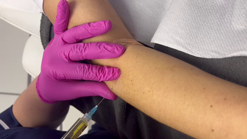 PRP Joints and Soft Tissue Injections Types, Uses and Risks
