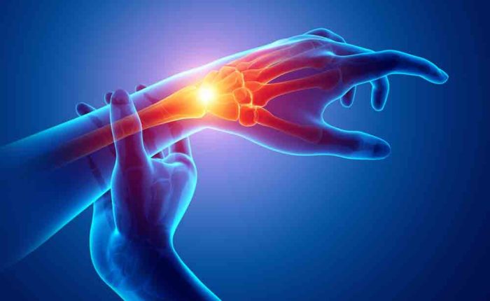Hand/ Wrist Pain