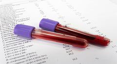 Private Blood Test Private Blood Test