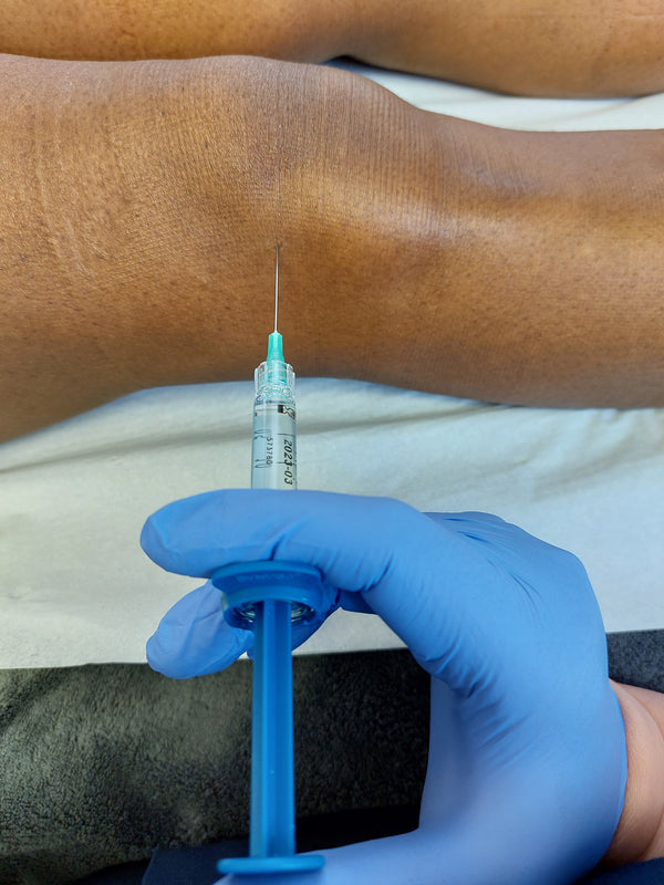 Hyaluronic Acid Joint Injections